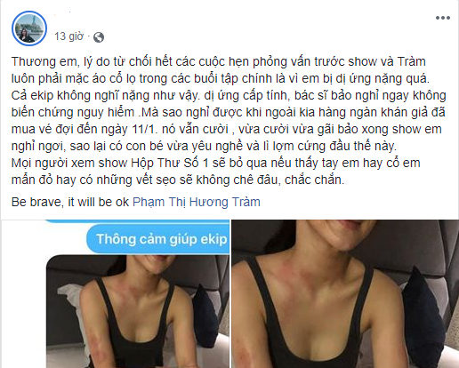 Hương Tràm bị dị ứng cấp tính, nổi đỏ khắp người trước thềm liveshow đầu tiên trong sự nghiệp ảnh 1