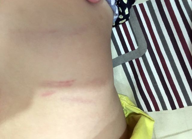 Con bị cô giáo đánh, phụ huynh đòi bồi thường 100 triệu đồng: Tường trình của nhà trường ảnh 2