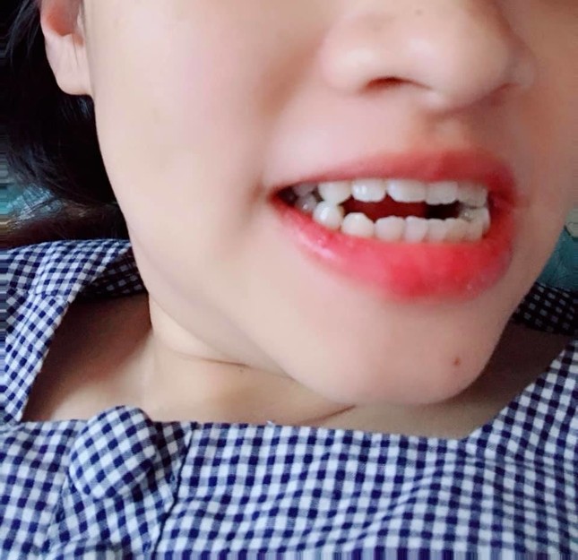 "Cười bò" với loạt ảnh minh chứng: Đúng là ông trời không cho ai tất cả! ảnh 9