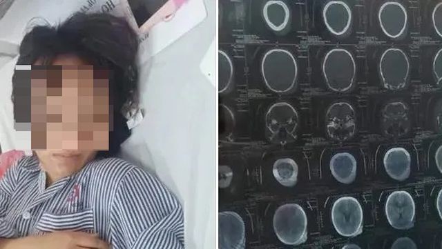 Quảng Ninh: Xác minh vụ nữ sinh bị đánh hội đồng đến tụ máu đầu ảnh 1