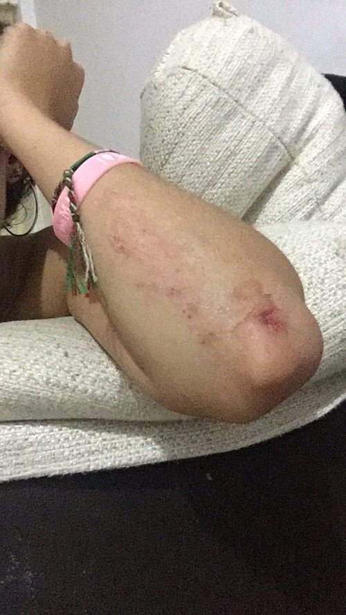 Cầu trượt dài nhất Tây Ban Nha đóng cửa sau 24 giờ hoạt động ảnh 2