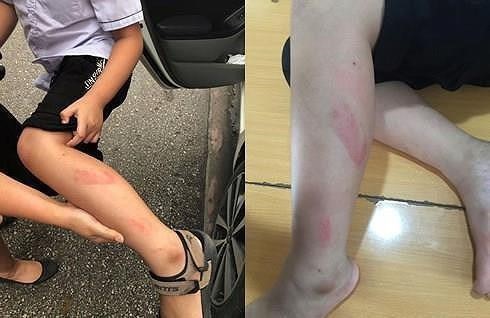 Đề nghị cho thôi việc cô giáo tát liên tiếp nhiều học sinh lớp 2 ảnh 2