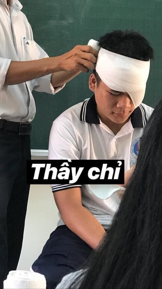 Loạt ảnh "thầy chỉ" và "học sinh làm" khi băng bó vết thương khác nhau "1 trời 1 vực" ảnh 1