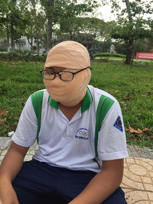 Loạt ảnh "thầy chỉ" và "học sinh làm" khi băng bó vết thương khác nhau "1 trời 1 vực" ảnh 5