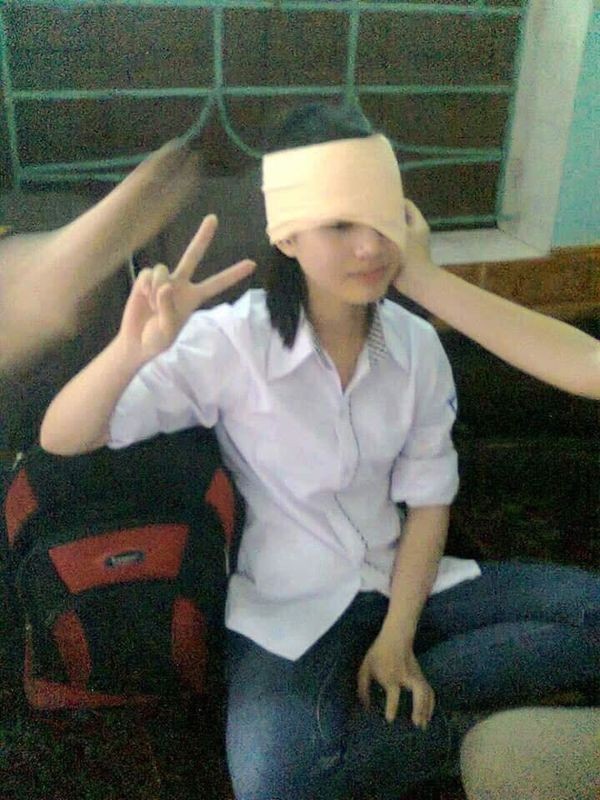 Loạt ảnh "thầy chỉ" và "học sinh làm" khi băng bó vết thương khác nhau "1 trời 1 vực" ảnh 10