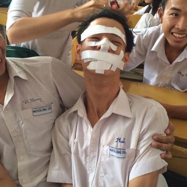 Loạt ảnh "thầy chỉ" và "học sinh làm" khi băng bó vết thương khác nhau "1 trời 1 vực" ảnh 14