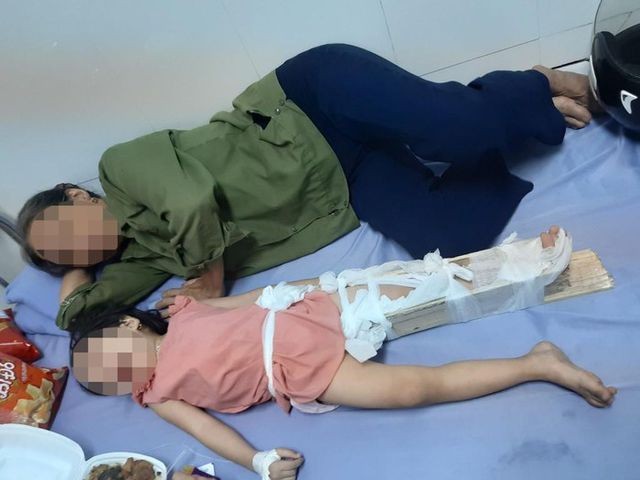 Phụ huynh “tố” học sinh gãy chân tại trường, hiệu trưởng trả lời vô cảm ảnh 1