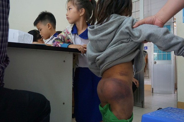 4 học sinh bị bạo hành ở Cà Mau: Ông nội và hai chị họ đánh ảnh 1