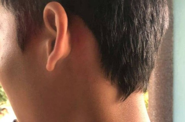 Thanh Hóa: 5 người lớn vào trường đánh nam sinh lớp 8 ảnh 1