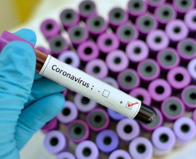 Australia tuyên bố đột phá trong việc kiềm chế virus corona ảnh 1