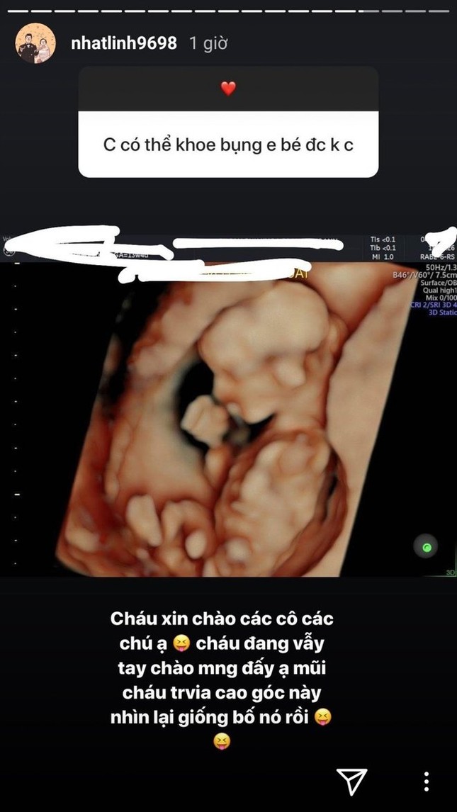 Vợ Phan Văn Đức khoe ảnh con đầu lòng, tiết lộ em bé có sống mũi cao giống bố ảnh 2