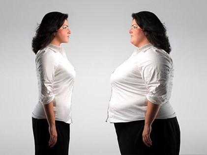 ‘Cánh cửa thoát hiểm’ cho người thừa cân béo phì