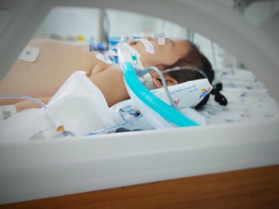 Bé gái nhập viện trong tình trạng nguy kịch phải hỗ trợ thở máy, điều trị tích cực