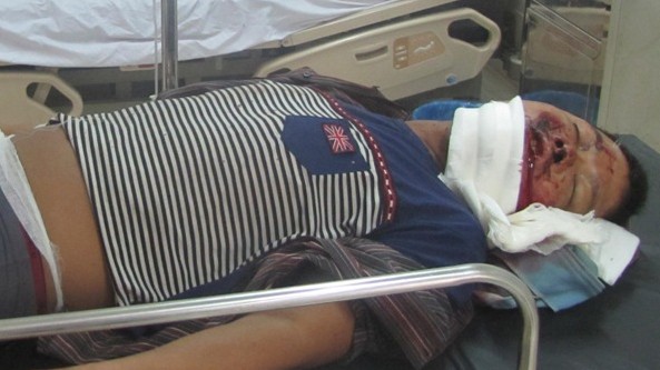 Những công nhân bị thương đang điều trị tại Bệnh viện Đa khoa Hà Tĩnh. 