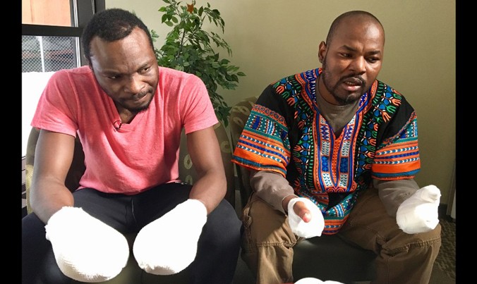 Hai người tị nạn Ghana bị bỏng lạnh, phải cắt bỏ ngón tay. Ảnh: CNN