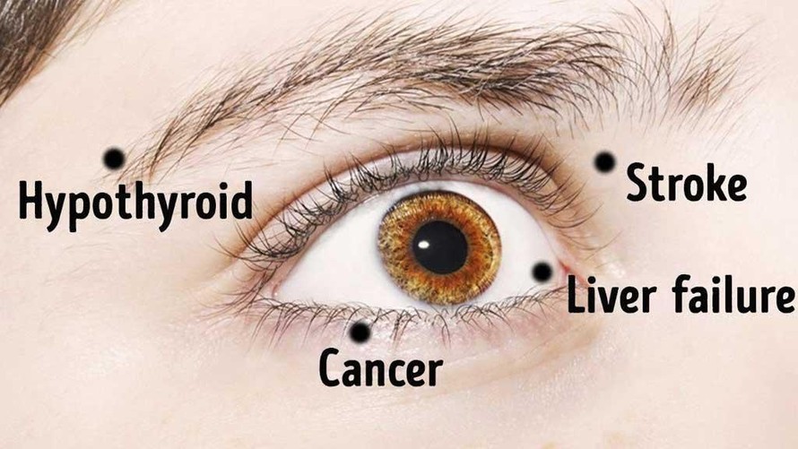 Từ bệnh tiểu đường, bệnh gan đến đột quỵ, u não… có thể được phát hiện qua đôi mắt. Ảnh SHUTTERSTOCK