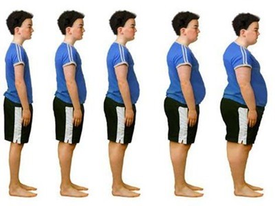 Mối liên hệ giữa bệnh Gout và béo phì