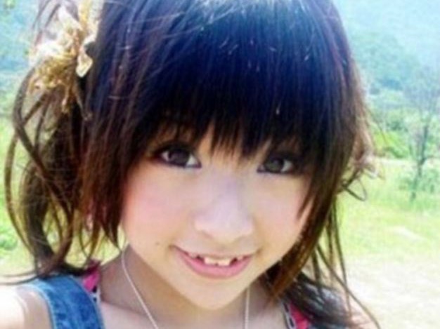 Theo nhiều thiếu nữ Nhật Bản, nanh nhọn mới là răng đẹp