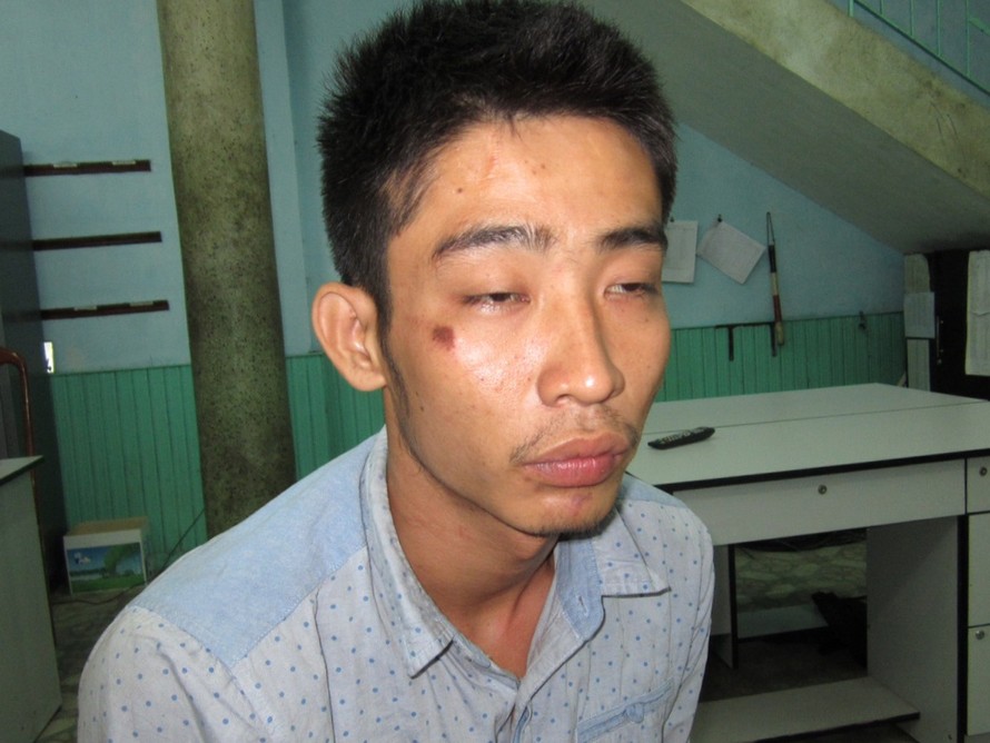Công an nổ súng trấn áp côn đồ có vũ khí