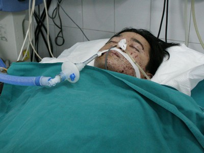 Bệnh nhân Chung đang điều trị tại bệnh viện Việt Đức