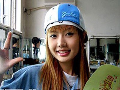 Những mỹ nhân mất mạng vì thẩm mỹ