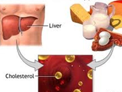 Làm gì để phòng ngừa tăng cholesterol máu?