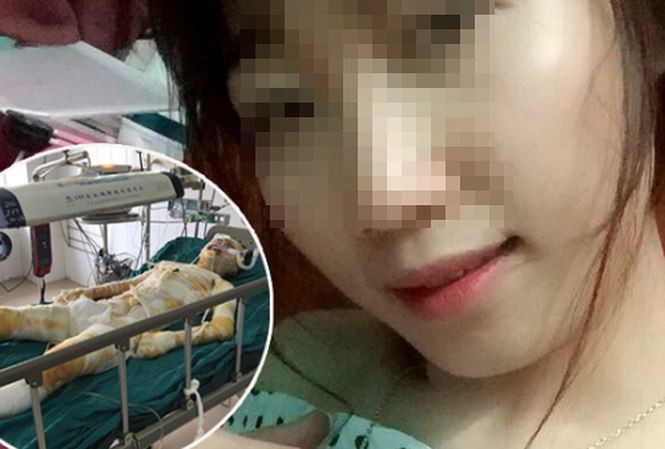 Chị H trước và sau khi bị tẩm xăng đốt.Ảnh: ANTĐ