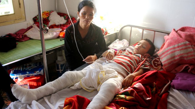Ba ngày sau khi Vĩnh bị cha đốt, chị Nguyễn Thị Xuân mới về được viện chăm sóc con. Ảnh: Hải Bình