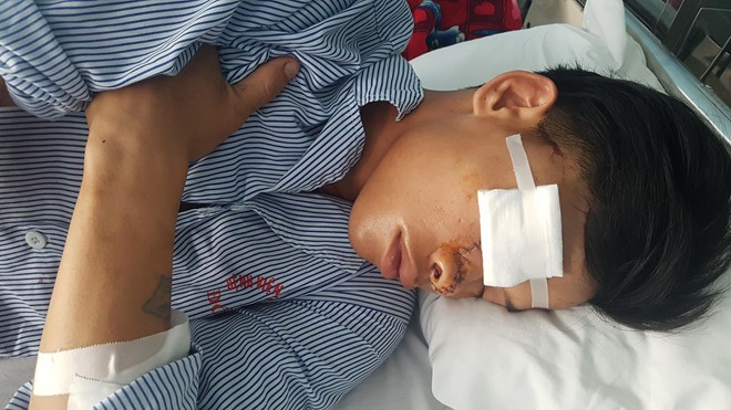 Đinh Luyên đang được điều trị tại Bệnh viện Hữu nghị Việt Nam Cuba Đồng Hới