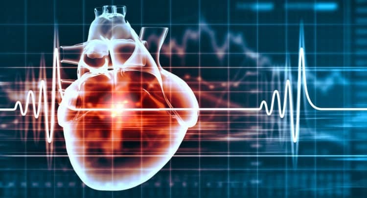 Cứu sống bệnh nhân suýt chết vì rối loạn nhịp tim hiếm gặp