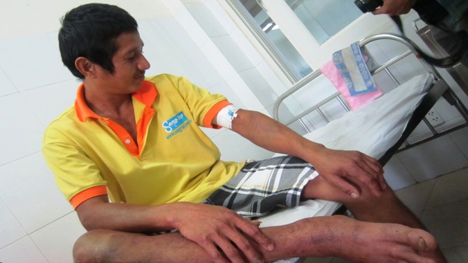 Anh Lê Viên Dũng, ở Nông Sơn (Quảng Nam) bị rắn lục đuôi đỏ cắn được chữa trị tại khoa y học nhiệt đới, BV Đa khoa Đà Nẵng.