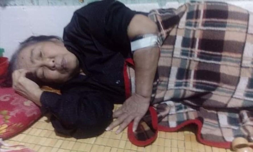 Bà Nguyễn Thị Hòa bị bệnh thận giai đoạn cuối sống lay lắt ở nhà trọ. Ảnh: PXD