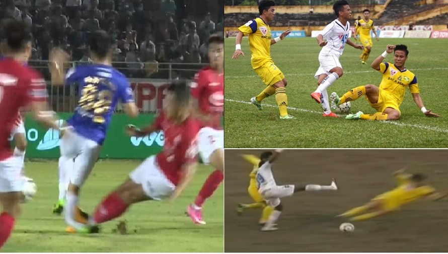 Những ca gãy chân kinh hoàng trong làng bóng đá Việt 