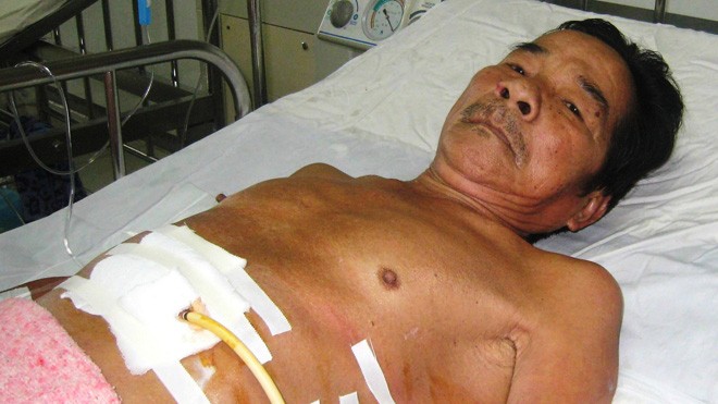 Ảnh do Bệnh viện T.Ư Huế cung cấp