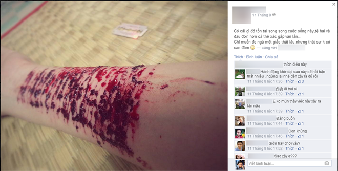 Hình ảnh cánh tay đầy máu do dùng dao lam rạch của M.N nhận được nhiều sự quan tâm của mọi người. Ảnh: Facebook M.N.