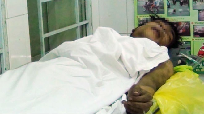 Anh Việt bị ám khói đen đang được cấp cứu tại Bệnh viện quận 7. Ảnh: An Nhơn
