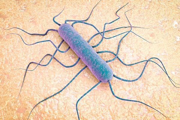 Listeria là vi khuẩn gây ra bệnh listeriosi