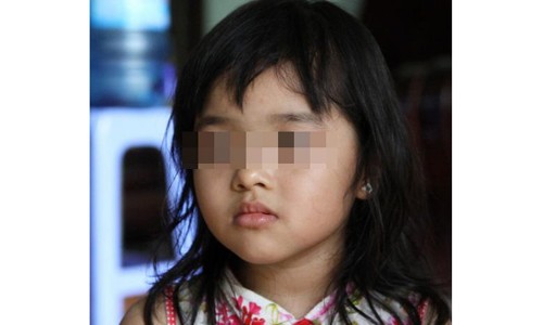 Bé H.T.N. (4 tuổi) kể bị cô giáo bạo hành rất dã man - Ảnh: VTC News