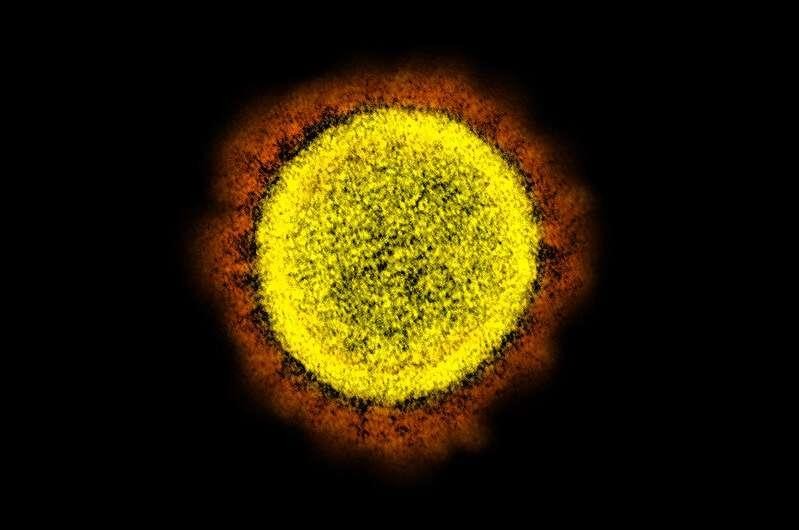 Virus SARS-CoV-2 có thể liên kết với siêu kháng thể của lạc đà và bị vô hiệu hóa.