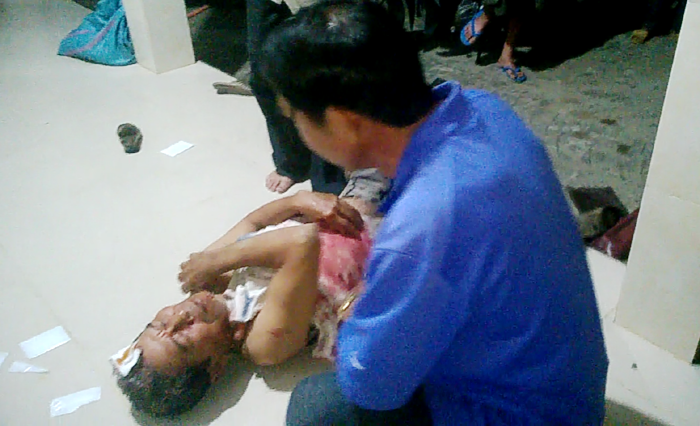 Nạn nhân Niệm bị "cát tặc" hung hãn tấn công vào đầu, người bê bết máu, phái nhập viện cấp cứu (ảnh do người dân cung cấp)