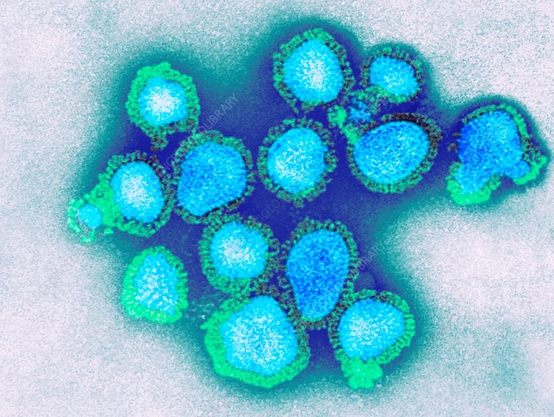 THẾ GIỚI 24H: Bùng phát dịch cúm A H3N2 tại nhiều tỉnh của Campuchia