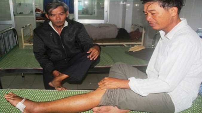 Ông Võ Văn Toán, nạn nhân bị rắn lục đuôi đỏ cắn vào chân trái đang điều trị tại Bệnh viện đa khoa Quảng Nam.