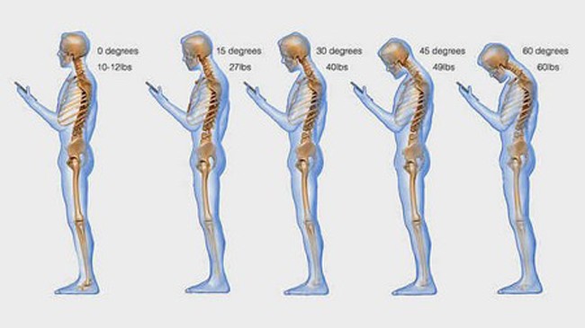 Thường xuyên cúi đầu để sử dụng smartphone và các thiết bị di động sẽ tác động không tốt đến cột sống cổ.