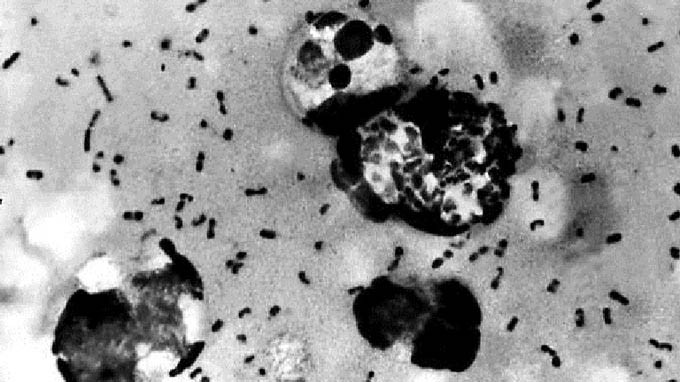 Vi khuẩn dịch hạch Yersinia pestis dưới kính hiển vi - Ảnh: AFP