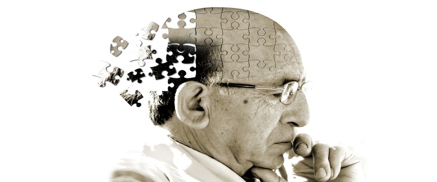 Ngủ nhiều làm tăng nguy cơ mắc bệnh Alzheimer