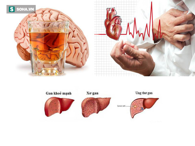 Uống rượu bia thường xuyên: 5 cơ quan nội tạng “bốc hơi” đáng giật ...