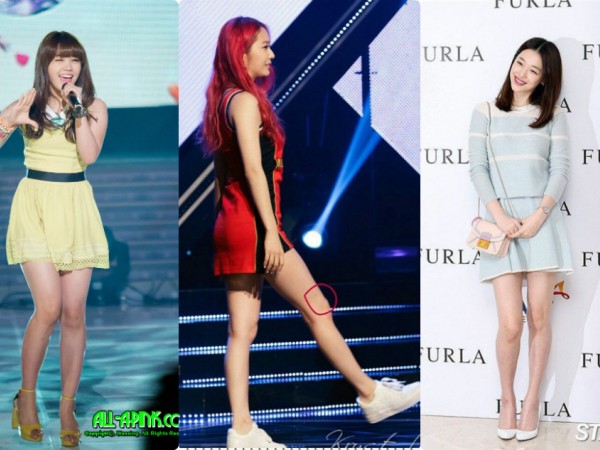 Đây là lý do khiến nhiều idol K-Pop bỗng dưng xuất hiện nốt ruồi bí ẩn ở trên chân