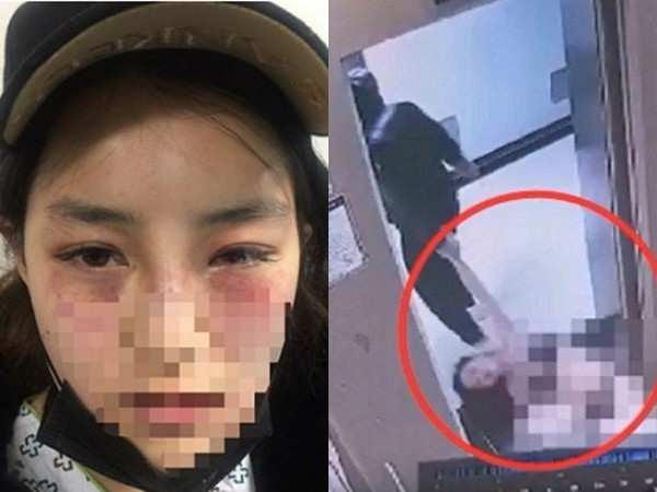Sôi sục vì nạn bạo hành ở Hàn Quốc: Đàn ông có thể đánh phụ nữ khi tức giận?