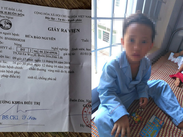 Đắk Lắk: Thầy giáo bị tố đấm vào mặt HS lớp 1: “Tôi vô tình quẹt tay vào mũi cháu”