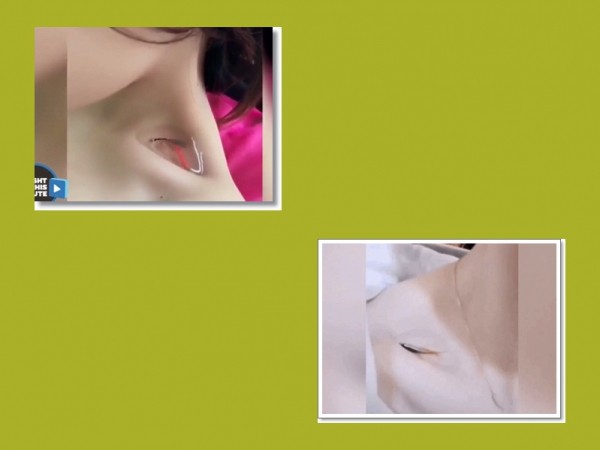 Giới trẻ lại phát sốt trước trào lưu thả cá vào xương quai xanh để đọ dáng "mình hạc xương mai"